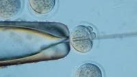 GeneEditing