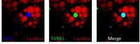 Apoptotic brown adipocytes enhance energy expenditure via extracellular inosine