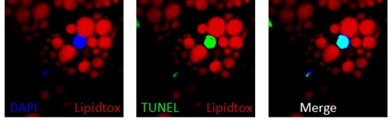 Apoptotic brown adipocytes enhance energy expenditure via extracellular inosine